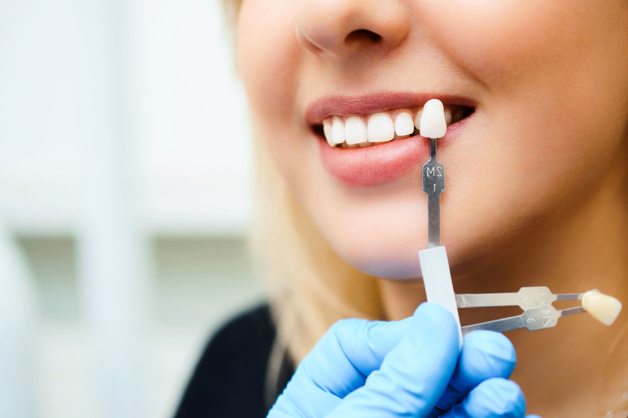 Cosmetic Fillings